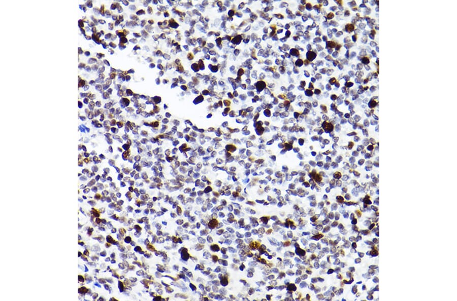 Immunohistochemistry - Anti-MCM2 Antibody [ARC2596] (A306885) - Antibodies.com