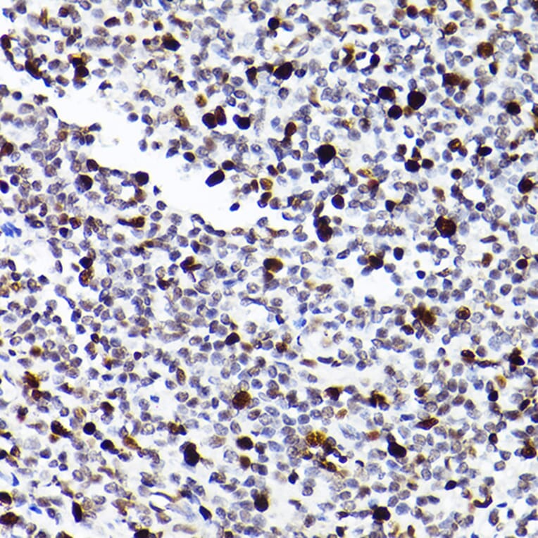 Immunohistochemistry - Anti-MCM2 Antibody [ARC2596] (A306885) - Antibodies.com