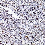 Immunohistochemistry - Anti-MCM2 Antibody [ARC2596] (A306885) - Antibodies.com