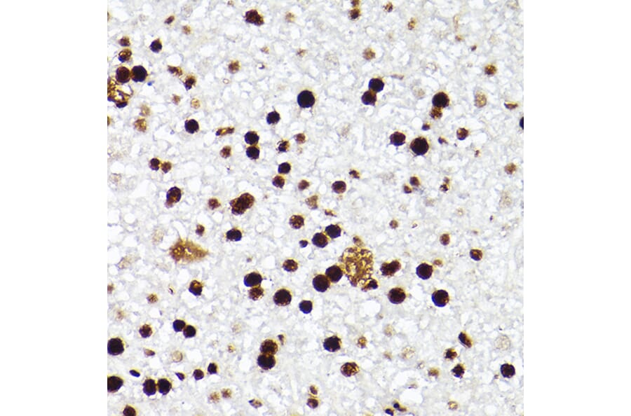 Immunohistochemistry - Anti-MCM2 Antibody [ARC2596] (A306885) - Antibodies.com