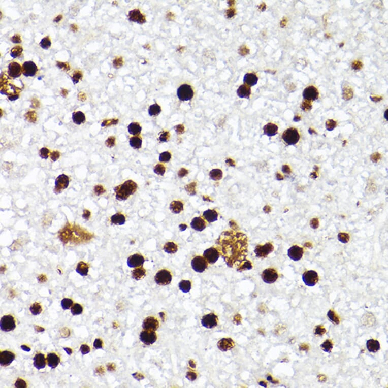 Immunohistochemistry - Anti-MCM2 Antibody [ARC2596] (A306885) - Antibodies.com