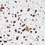 Immunohistochemistry - Anti-MCM2 Antibody [ARC2596] (A306885) - Antibodies.com
