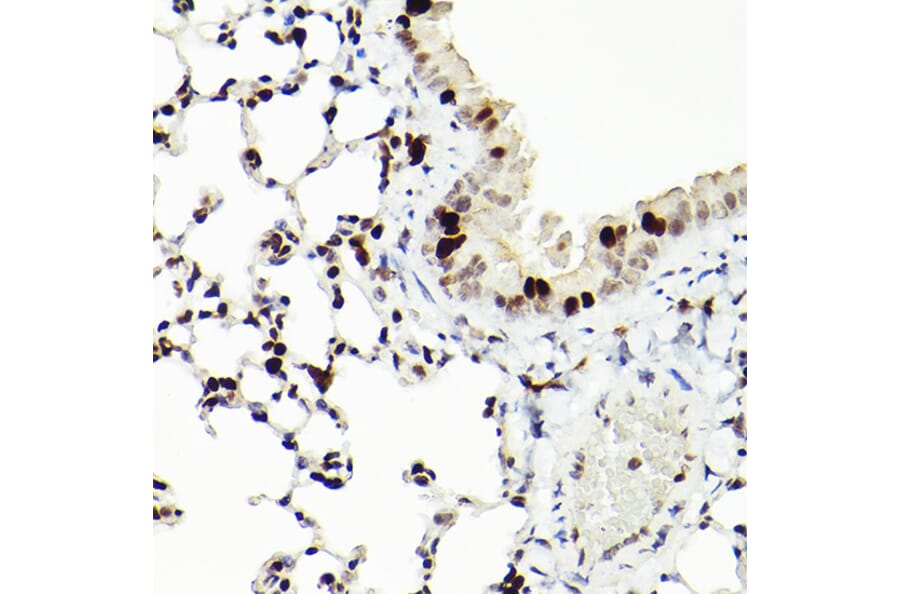 Immunohistochemistry - Anti-MCM2 Antibody [ARC2596] (A306885) - Antibodies.com