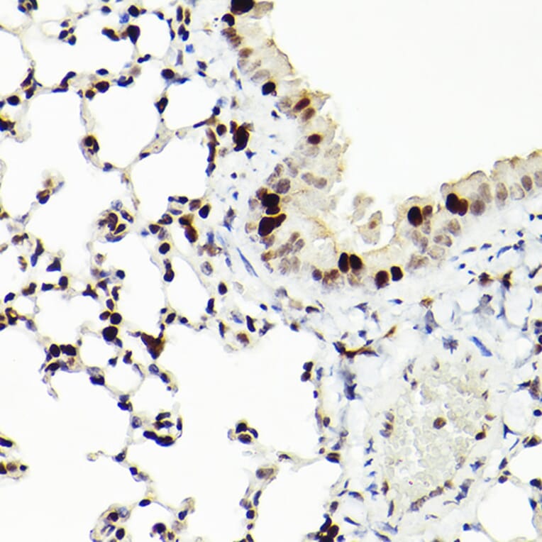 Immunohistochemistry - Anti-MCM2 Antibody [ARC2596] (A306885) - Antibodies.com