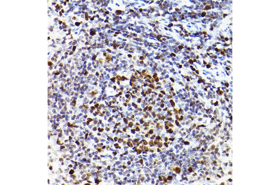 Immunohistochemistry - Anti-MCM2 Antibody [ARC2596] (A306885) - Antibodies.com