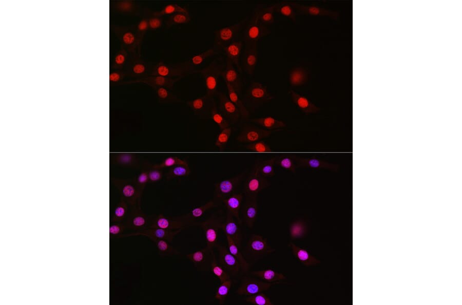 Immunofluorescence - Anti-MCM2 Antibody [ARC2596] (A306885) - Antibodies.com
