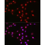 Immunofluorescence - Anti-MCM2 Antibody [ARC2596] (A306885) - Antibodies.com