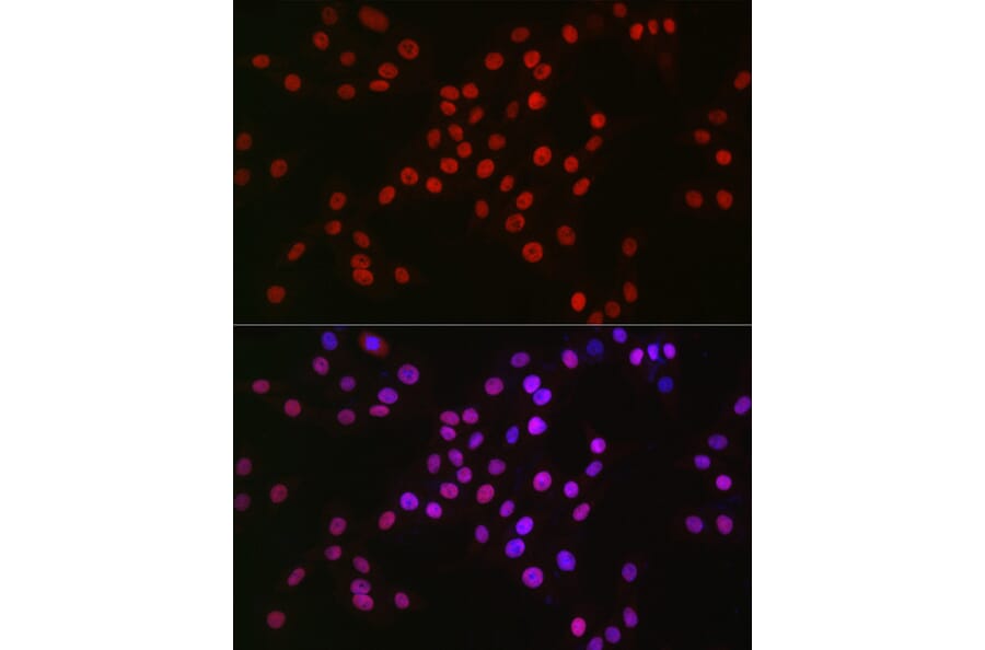 Immunofluorescence - Anti-MCM2 Antibody [ARC2596] (A306885) - Antibodies.com