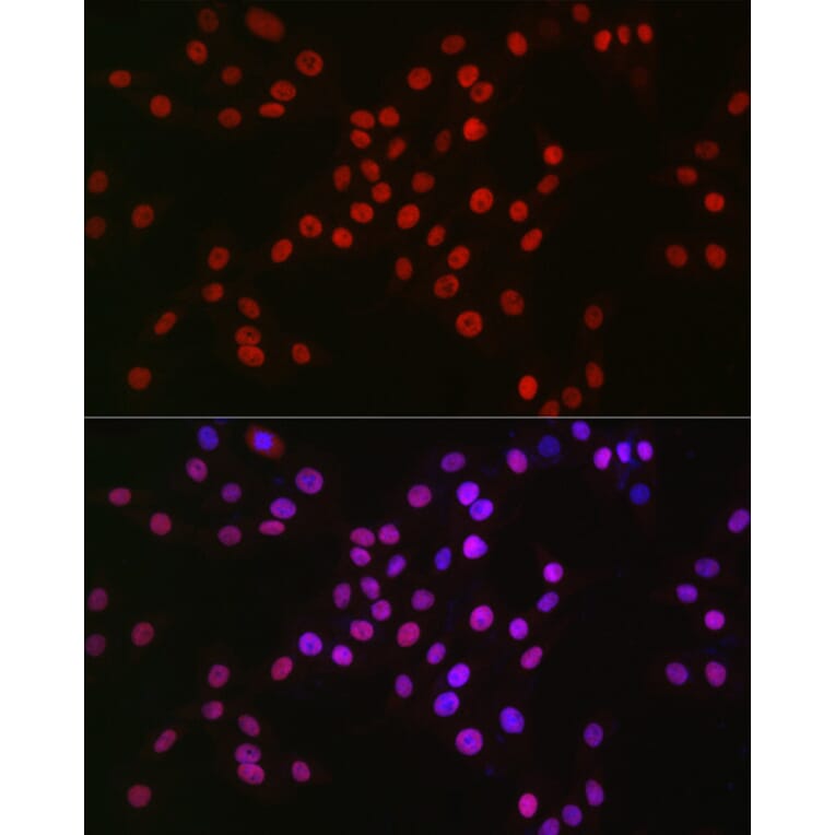 Immunofluorescence - Anti-MCM2 Antibody [ARC2596] (A306885) - Antibodies.com