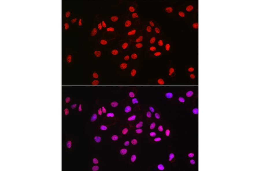 Immunofluorescence - Anti-MCM2 Antibody [ARC2596] (A306885) - Antibodies.com