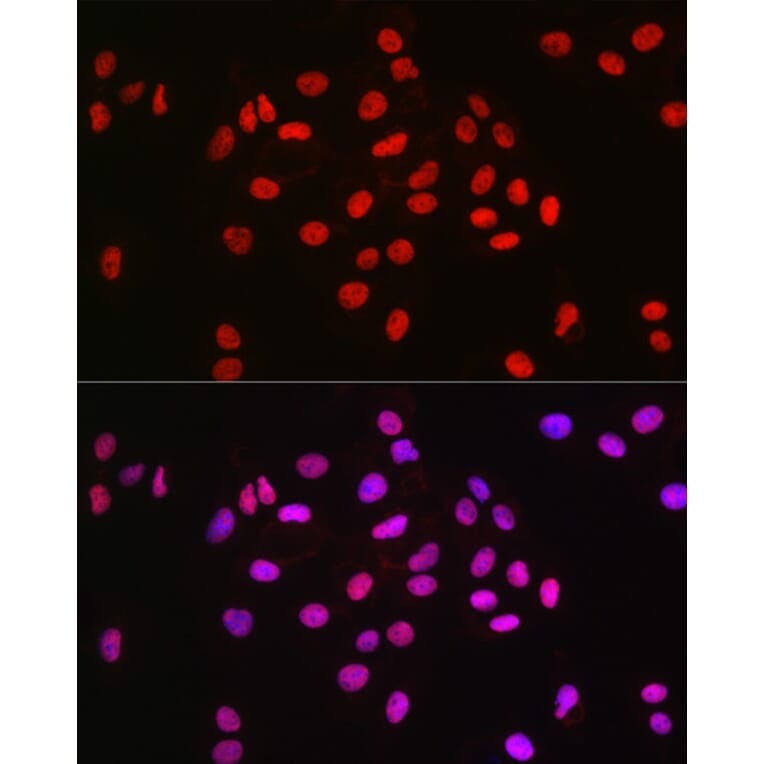 Immunofluorescence - Anti-MCM2 Antibody [ARC2596] (A306885) - Antibodies.com