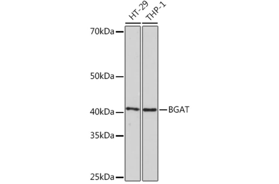 Western Blot - Anti-ABO Antibody [ARC1251] (A306886) - Antibodies.com