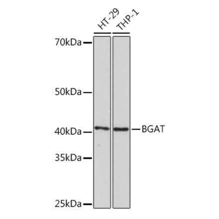 Western Blot - Anti-ABO Antibody [ARC1251] (A306886) - Antibodies.com