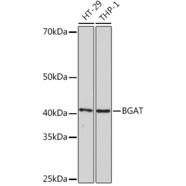 Western Blot - Anti-ABO Antibody [ARC1251] (A306886) - Antibodies.com