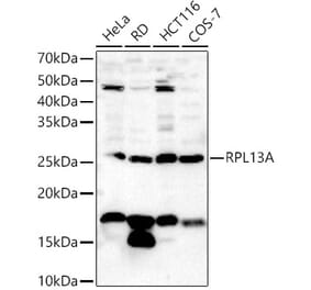 Western Blot - Anti-RPL13A Antibody (A306887) - Antibodies.com