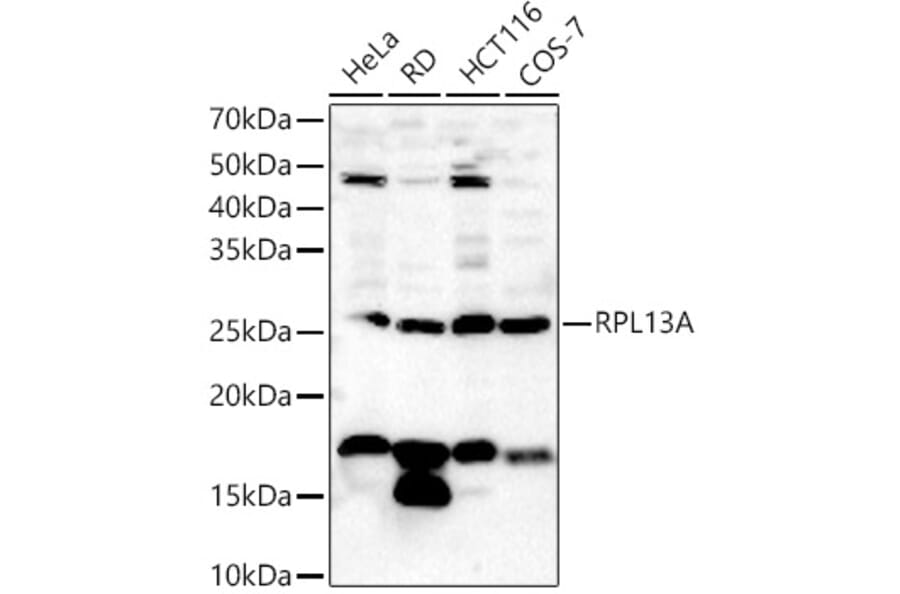 Western Blot - Anti-RPL13A Antibody (A306887) - Antibodies.com