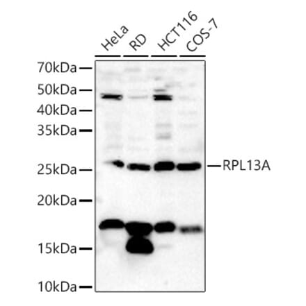 Western Blot - Anti-RPL13A Antibody (A306887) - Antibodies.com