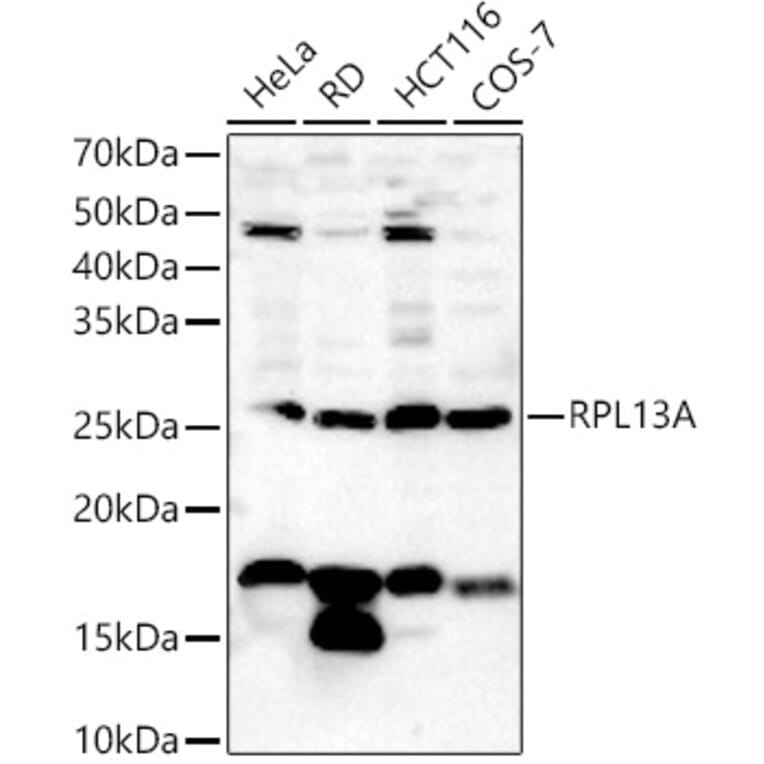 Western Blot - Anti-RPL13A Antibody (A306887) - Antibodies.com