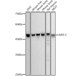 Western Blot - Anti-AdSS 2 Antibody [ARC2931] (A306888) - Antibodies.com