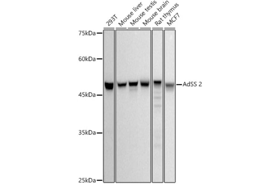 Western Blot - Anti-AdSS 2 Antibody [ARC2931] (A306888) - Antibodies.com