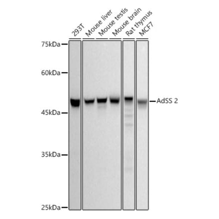 Western Blot - Anti-AdSS 2 Antibody [ARC2931] (A306888) - Antibodies.com