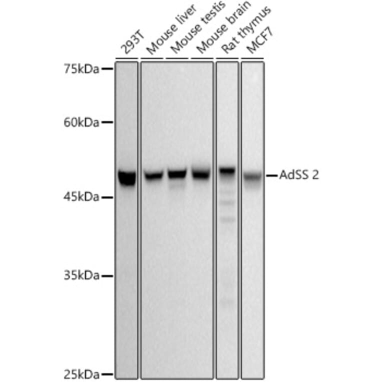 Western Blot - Anti-AdSS 2 Antibody [ARC2931] (A306888) - Antibodies.com