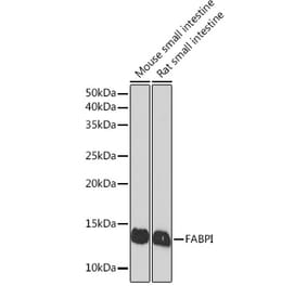 Western Blot - Anti-I-FABP Antibody [ARC1343] (A306889) - Antibodies.com