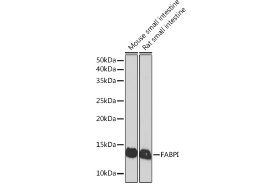 Western Blot - Anti-I-FABP Antibody [ARC1343] (A306889) - Antibodies.com