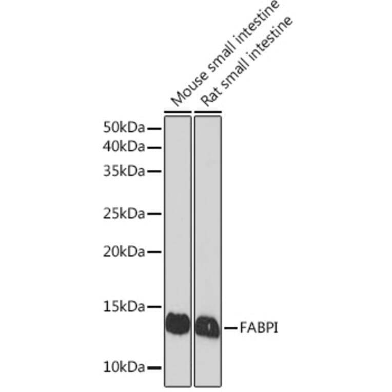 Western Blot - Anti-I-FABP Antibody [ARC1343] (A306889) - Antibodies.com