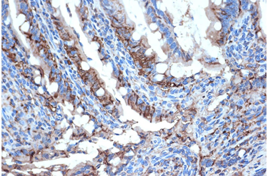 Immunohistochemistry - Anti-I-FABP Antibody [ARC1343] (A306889) - Antibodies.com