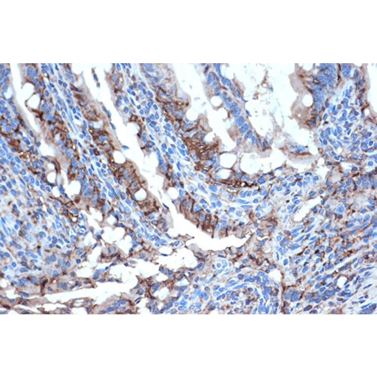 Immunohistochemistry - Anti-I-FABP Antibody [ARC1343] (A306889) - Antibodies.com