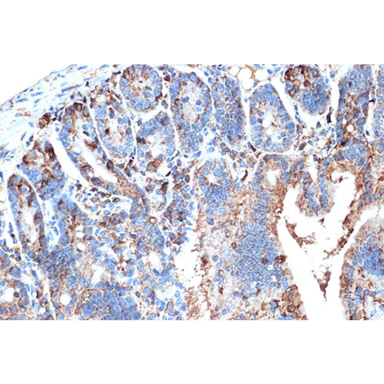 Immunohistochemistry - Anti-I-FABP Antibody [ARC1343] (A306889) - Antibodies.com