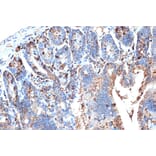 Immunohistochemistry - Anti-I-FABP Antibody [ARC1343] (A306889) - Antibodies.com