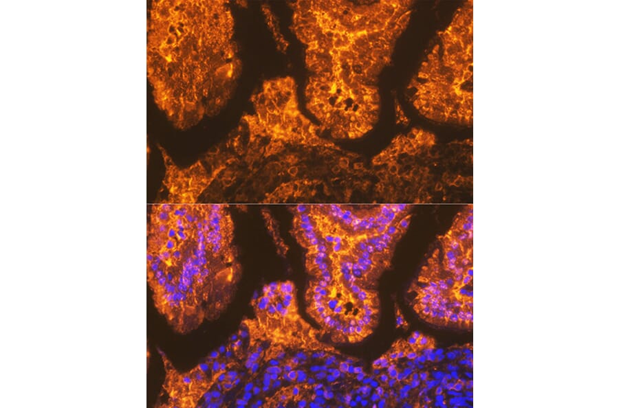 Immunofluorescence - Anti-I-FABP Antibody [ARC1343] (A306889) - Antibodies.com