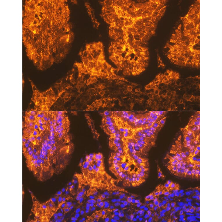 Immunofluorescence - Anti-I-FABP Antibody [ARC1343] (A306889) - Antibodies.com
