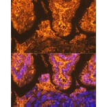 Immunofluorescence - Anti-I-FABP Antibody [ARC1343] (A306889) - Antibodies.com