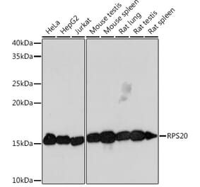 Western Blot - Anti-RPS20 Antibody [ARC1630] (A306890) - Antibodies.com