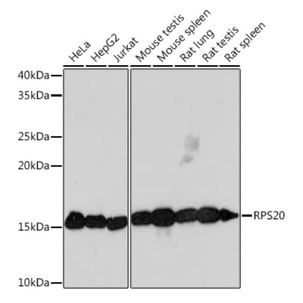 Western Blot - Anti-RPS20 Antibody [ARC1630] (A306890) - Antibodies.com