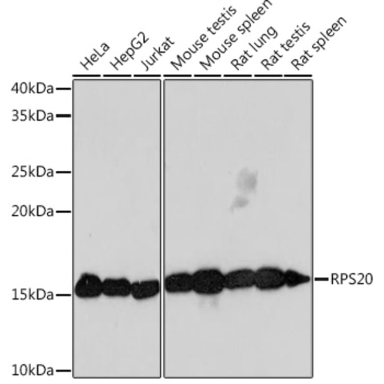 Western Blot - Anti-RPS20 Antibody [ARC1630] (A306890) - Antibodies.com