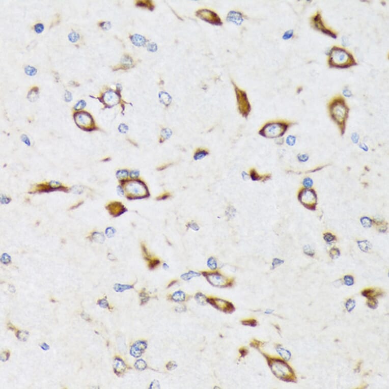 Immunohistochemistry - Anti-RPS20 Antibody [ARC1630] (A306890) - Antibodies.com