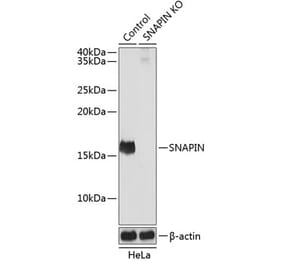 Western Blot - Anti-SNAPIN Antibody (A306891) - Antibodies.com