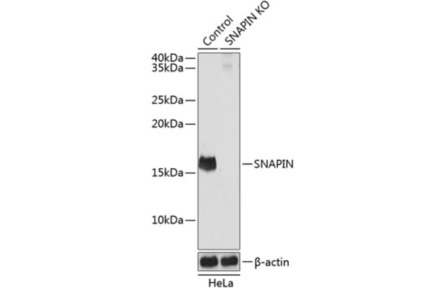 Western Blot - Anti-SNAPIN Antibody (A306891) - Antibodies.com