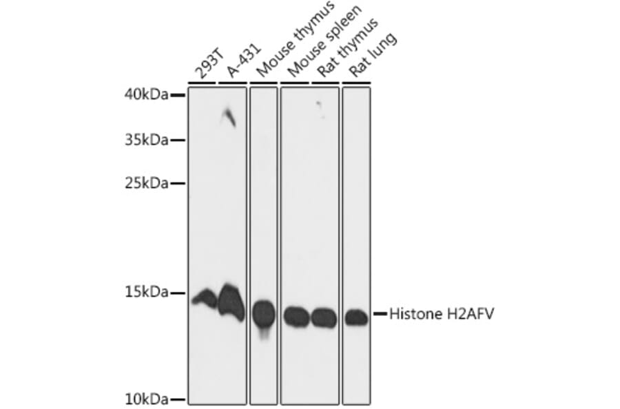 Western Blot - Anti-H2AZ2 Antibody (A306892) - Antibodies.com