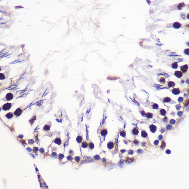 Immunohistochemistry - Anti-H2AZ2 Antibody (A306892) - Antibodies.com