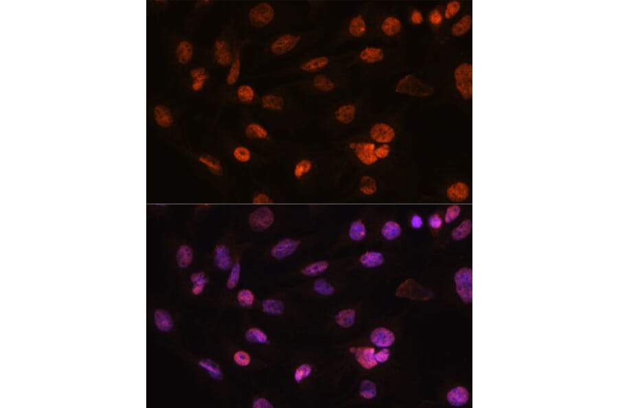 Immunofluorescence - Anti-H2AZ2 Antibody (A306892) - Antibodies.com