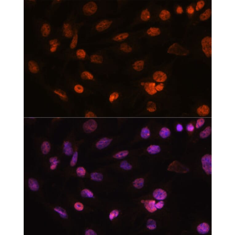 Immunofluorescence - Anti-H2AZ2 Antibody (A306892) - Antibodies.com