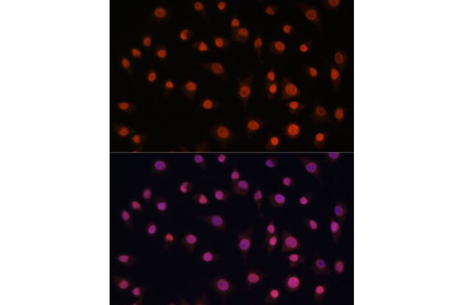 Immunofluorescence - Anti-H2AZ2 Antibody (A306892) - Antibodies.com