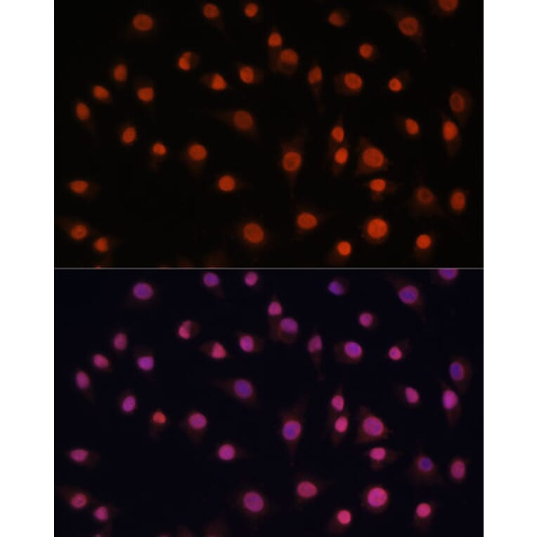 Immunofluorescence - Anti-H2AZ2 Antibody (A306892) - Antibodies.com