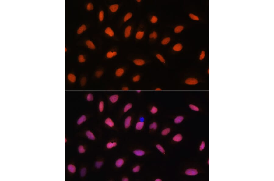 Immunofluorescence - Anti-H2AZ2 Antibody (A306892) - Antibodies.com