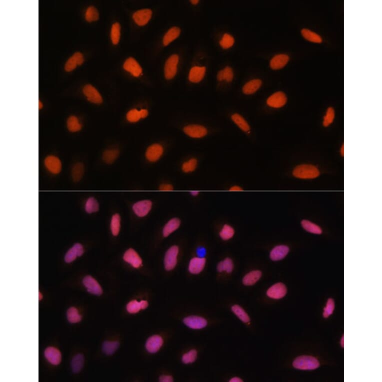 Immunofluorescence - Anti-H2AZ2 Antibody (A306892) - Antibodies.com